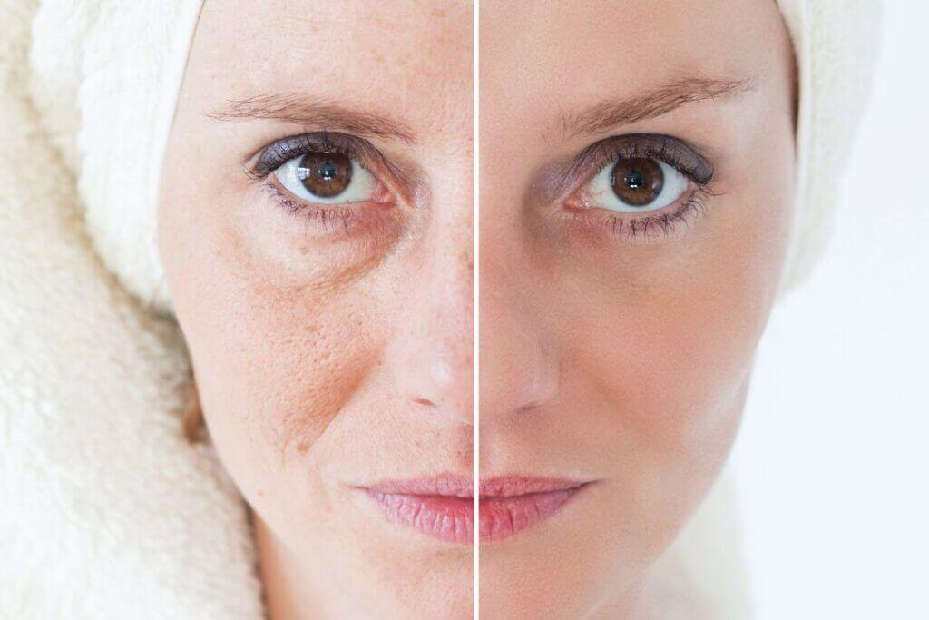 How and Why Skin Ages